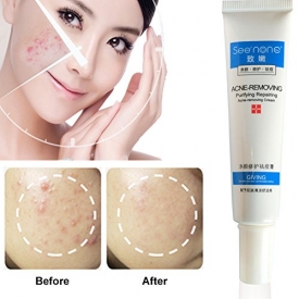 Anti Acne Cream, Acne Scar Removal Cream, Acne Cleaning Cream, Scar Removal Cream Skin Repair Face Cream Acne Spot Treatment Cream for Pimples & Blackhead, Get Rid of Acne Scars (25ml)