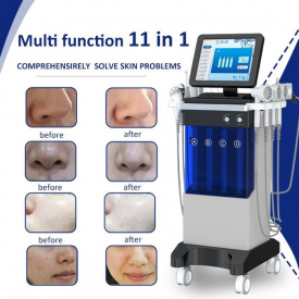 2022 Professional Microdermabrasion Face Skin Hydrate Oxygen Facial Machine Hydro Solution 14 In 1 Beauty Equipment