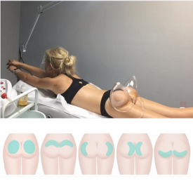 Breast Enlargeme buttock liftin Therapy Cellulite Cupping Machine For Guasha, Skin Tightening, Butt Lifting, Breast Enlargement Dropshipping