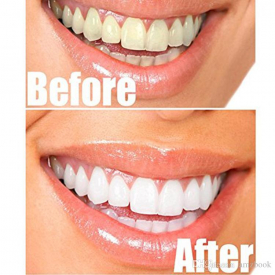 All Natural and Organic Activated Charcoal Teeth Cleaning Tooth and Gum Powder + toothbrush set Total teeth Whites 30g